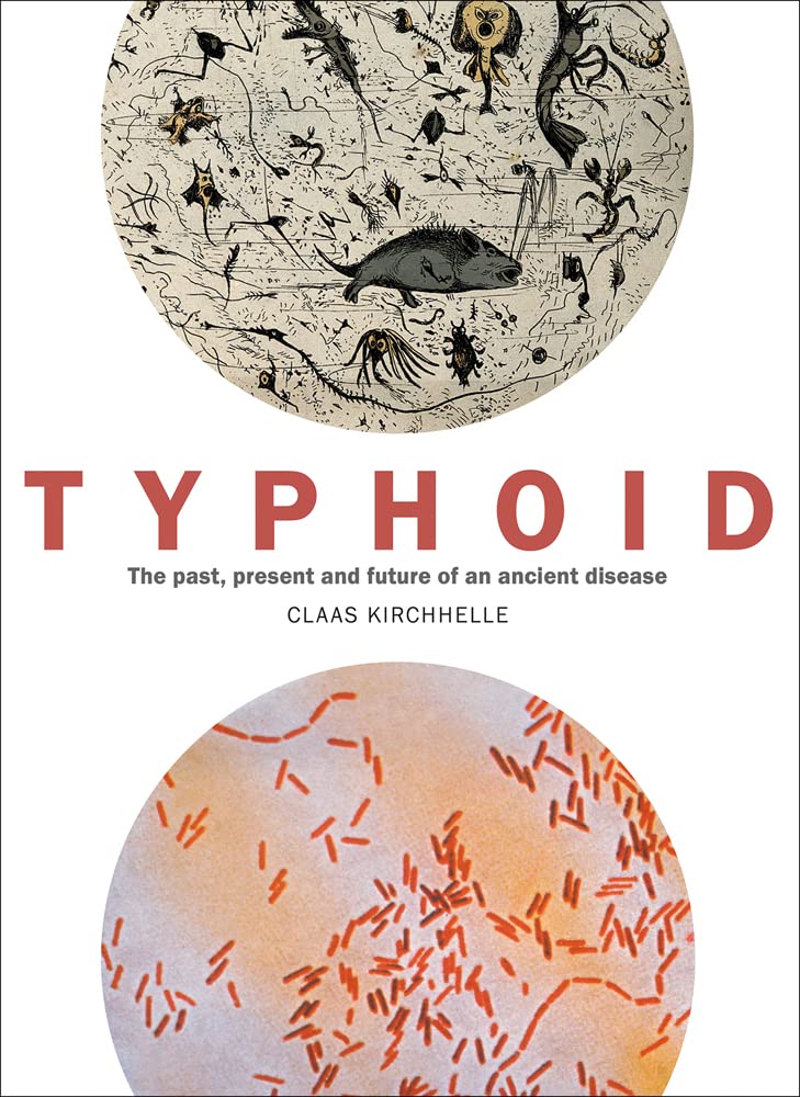 Typhoid: The past, present, and future of an ancient disease, by Claas Kirchhelle
